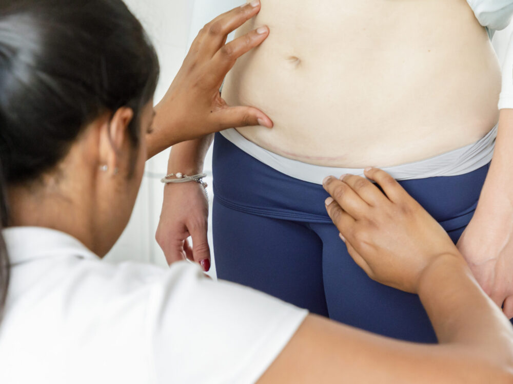  C-Section Scar Massage