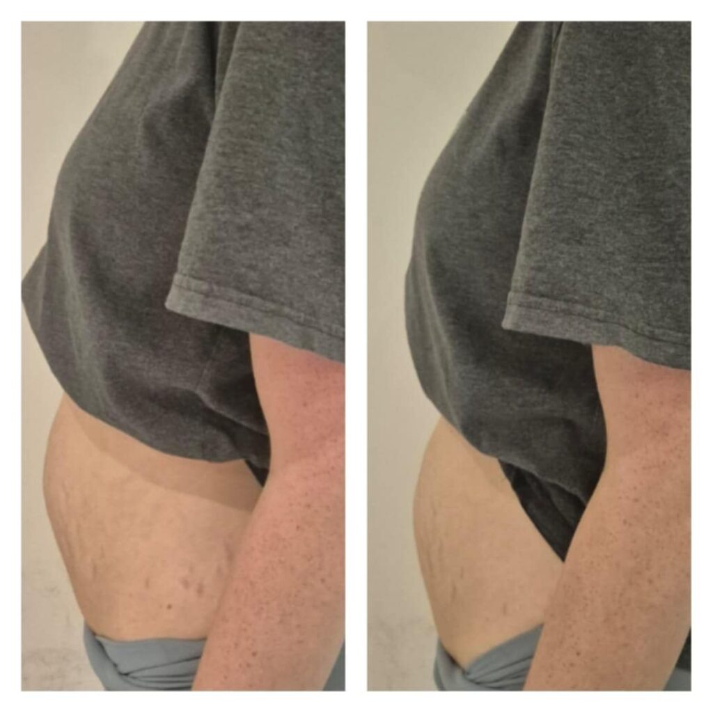 before and after