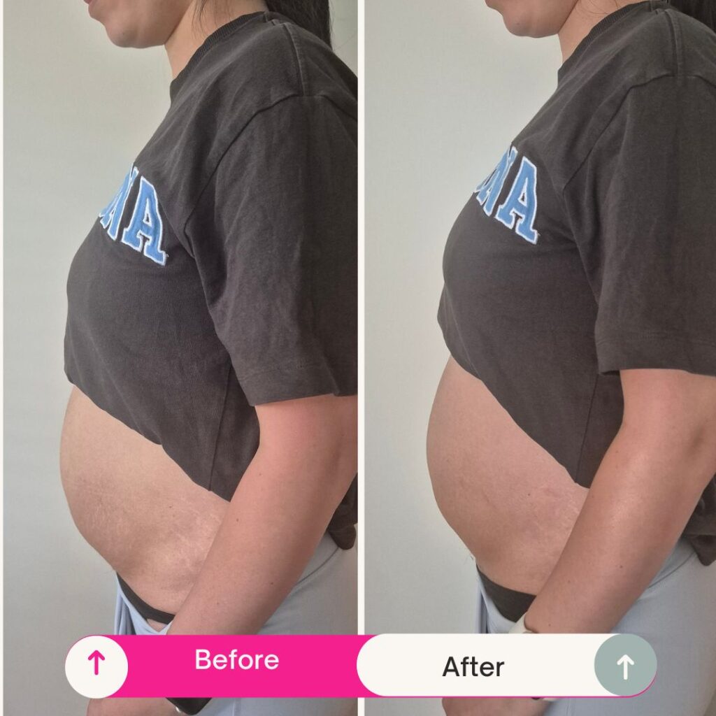 before and after