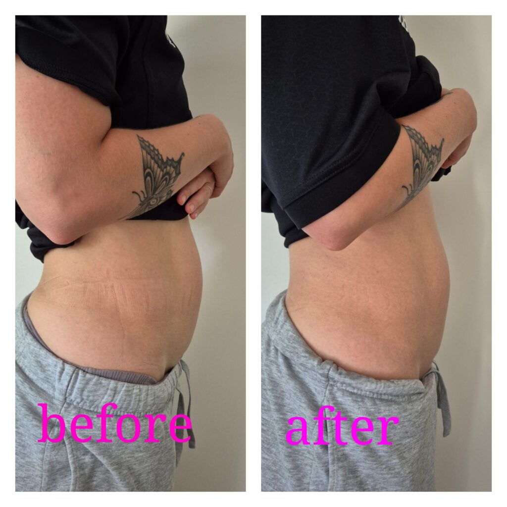 image sto show before and after treatment